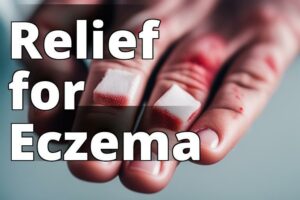 The Ultimate Guide To Cbd Oil Benefits For Eczema Treatment: Everything You Need To Know